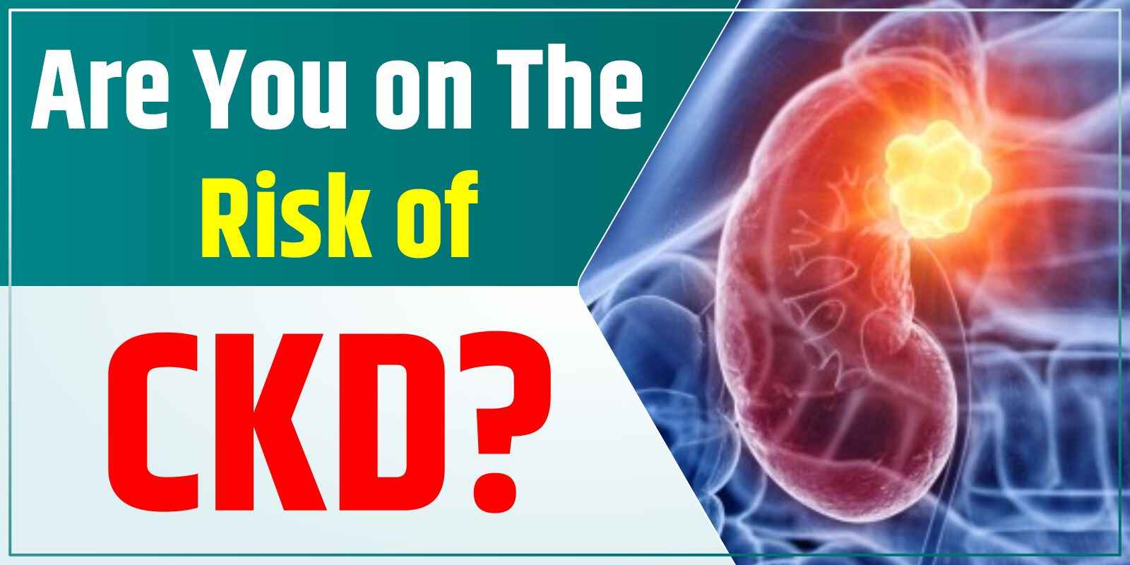 Are You on The Risk of CKD?